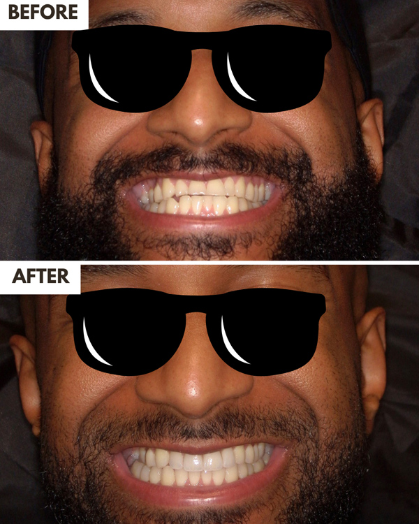 Dentures Case 1