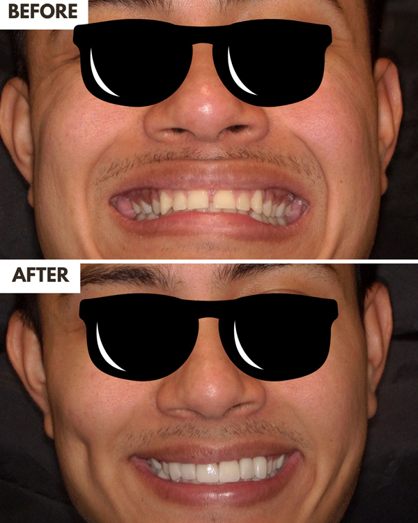 Dentures Case 1