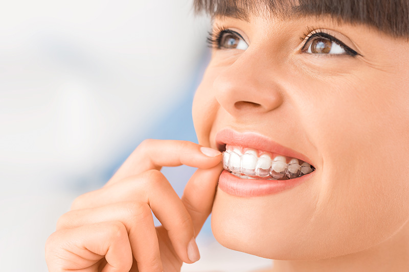 Invisalign in Maspeth